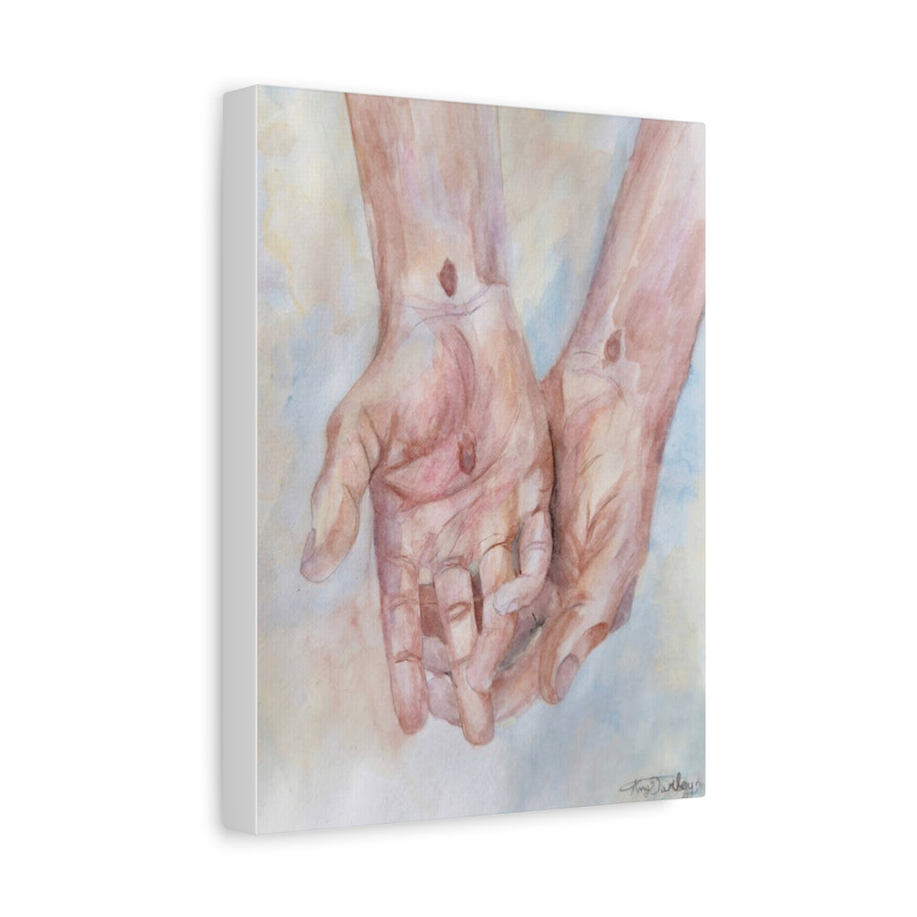 Behold The Wounds | Canvas Print